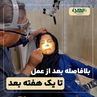 جراحی-بینی-7