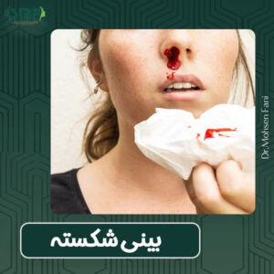 بینی شکسته - دکتر محسن فانی