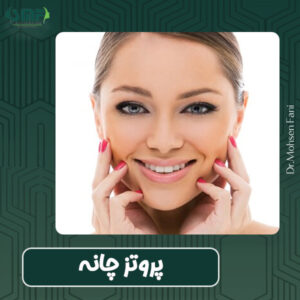 پروتز چانه - دکتر سید محسن فانی