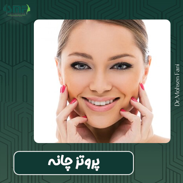 پروتز چانه - دکتر سید محسن فانی 