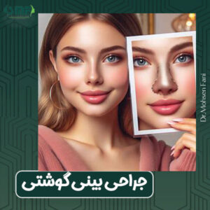 جراحی بینی گوشتی دکتر سید محسن فانی در یزد