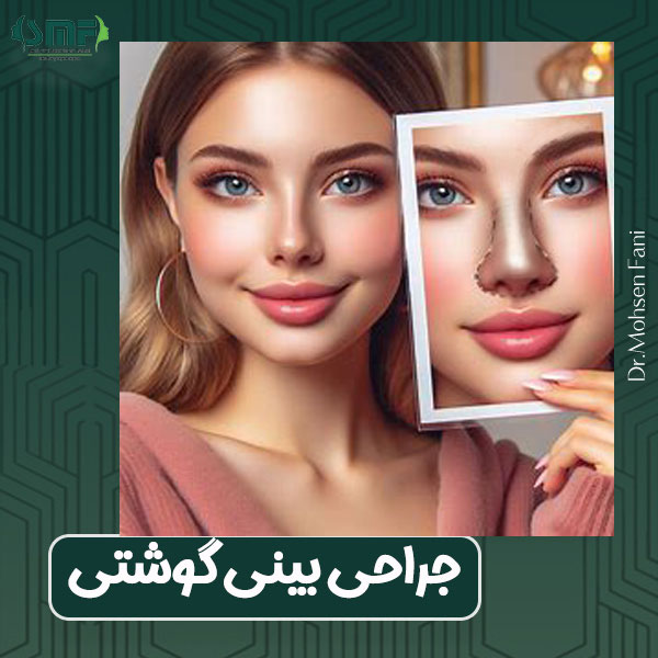 جراحی بینی گوشتی دکتر سید محسن فانی در یزد
