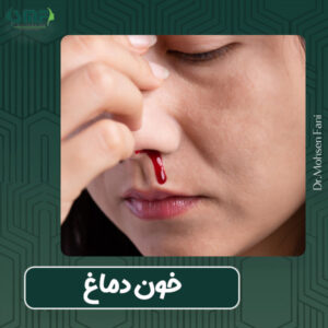 خون دماغ و درمان آن - دکتر محسن فانی