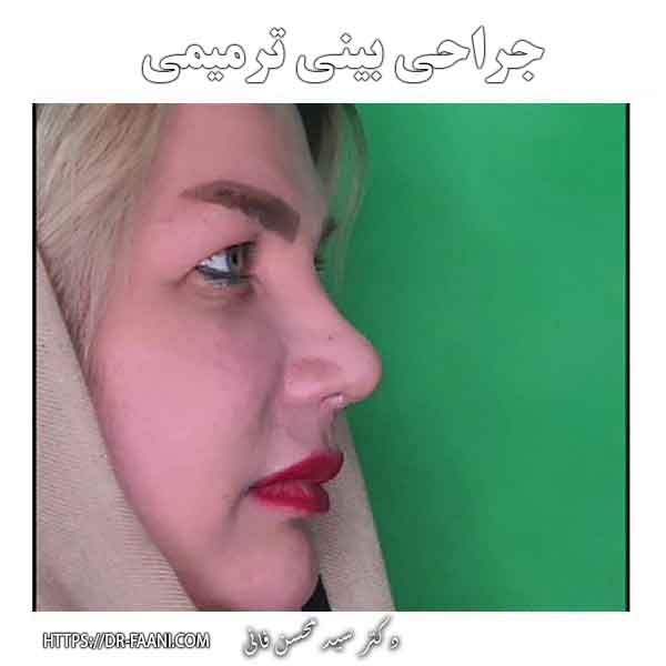 جراحی بینی ترمیمی