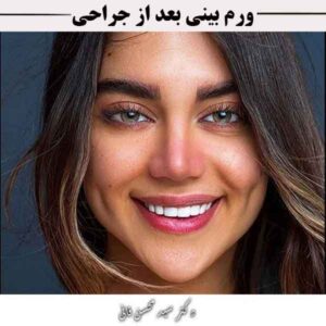 ورم بینی بعد از جراحی
