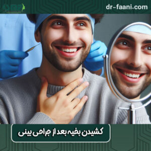 کشیدن بخیه بعد از جراحی بینی از دکتر سید محسن فانی ، بهترین جراح بینی یزد