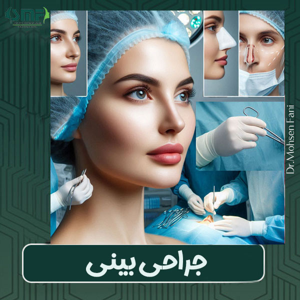 جراحی بینی دکتر سید محسن فانی در یزد