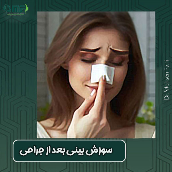 سوزش بینی بعد از عمل ، دکتر سید محسن فانی در یزد