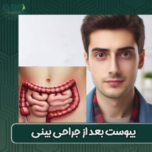 یبوست بعد از جراحی بینی دکتر فانی در یزد