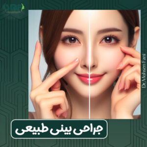 جراحی بینی طبیعی از دکتر سید محسن فانی بهترین جراح بینی یزد