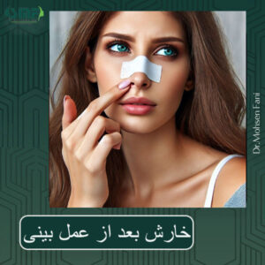 خارش بعد از جراحی بینی از دکتر سید محسن فانی بهترین جراح بینی یزد