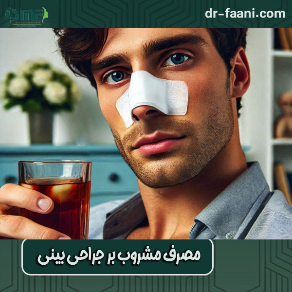 مصرف مشروب بر جراحی بینی از دکتر سید محسن فانی ، بهترین جراح بینی در یزد