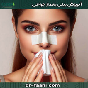 آبریزش بینی بعد از جراحی از دکتر سید محسن فانی ، بهترین جراح بینی یزد