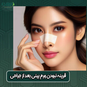 قرینه نبودن ورم بینی بعد از جراحی از بهترین جراح بینی در یزد