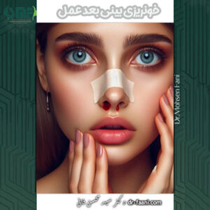 خونریزی بعد از عمل بینی - دکتر سید محسن فانی - dr-faani.com