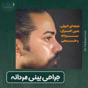 عمل بینی مردانه - دکتر سید محسن فانی -dr-faani.com