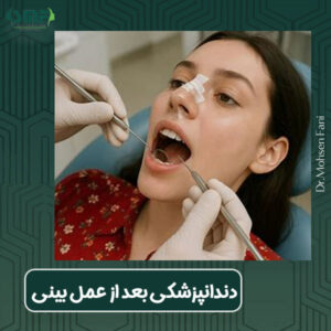 دندان پزشکی بعد از عمل بینی - دکتر محسن فانی - dr-faani.com