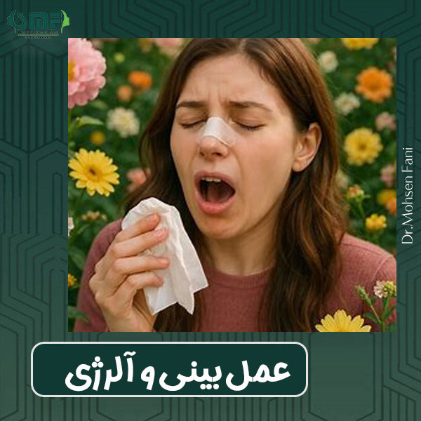 عمل بین و آلرژی- دکتر سید محسن فانی - dr-faani.com