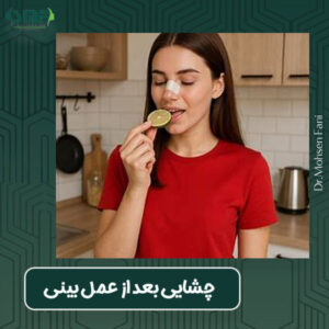 چشایی بعد از عمل بینی - دکتر سید محسن فانی - dr-faani.com